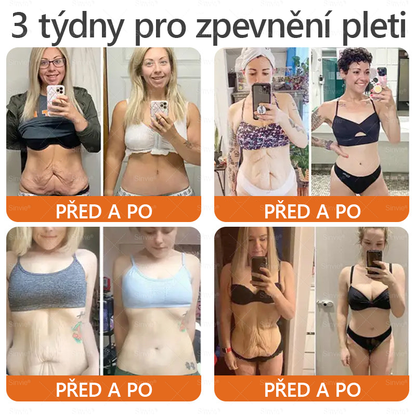 🐝 Sinvie® Krém na obnovu pleti s včelím jedem(👨‍⚕‍CE schváleno)👍✅