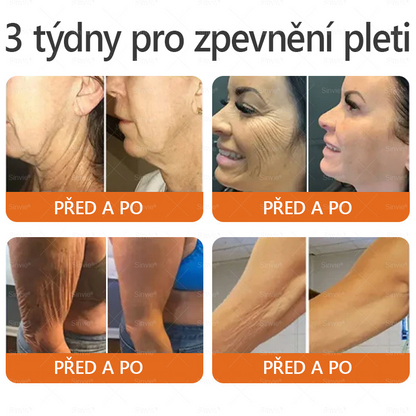 ✅Doporučení dermatologa 🐝 Sinvie® Krém na obnovu pleti s včelím jedem 🔥 Český vývoj, výroba a dodávka v České republice