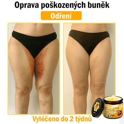 🐝 Sinvie® Krém na obnovu pleti s včelím jedem(👨‍⚕‍CE schváleno)👍✅