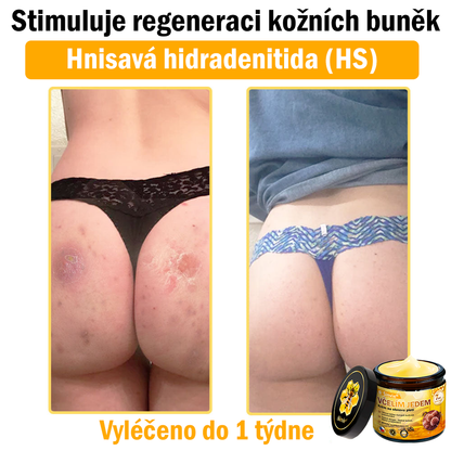 🐝 Sinvie® Krém na obnovu pleti s včelím jedem(👨‍⚕‍CE schváleno)👍✅