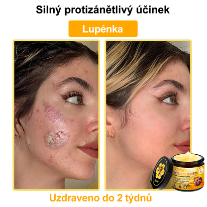 🐝 Sinvie® Krém na obnovu pleti s včelím jedem(👨‍⚕‍CE schváleno)👍✅