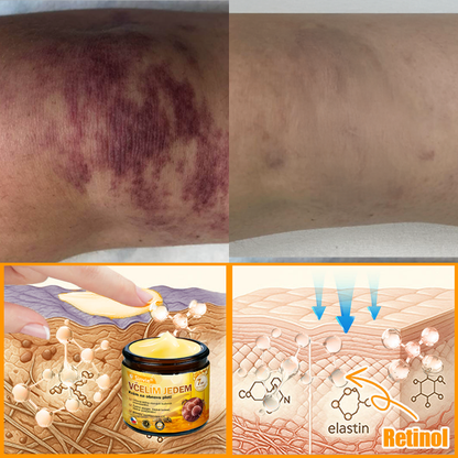 🐝 Sinvie® Krém na obnovu pleti s včelím jedem(👨‍⚕‍CE schváleno)👍✅